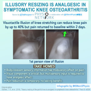 Illusion_SEP_PN_Infographic_KEVINWERNLIPHYSIO